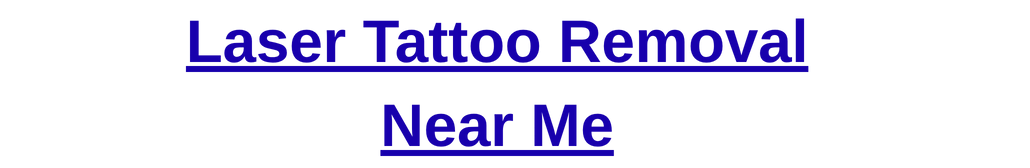 Laser Tattoo Removal Near Me | Remove Tattoo